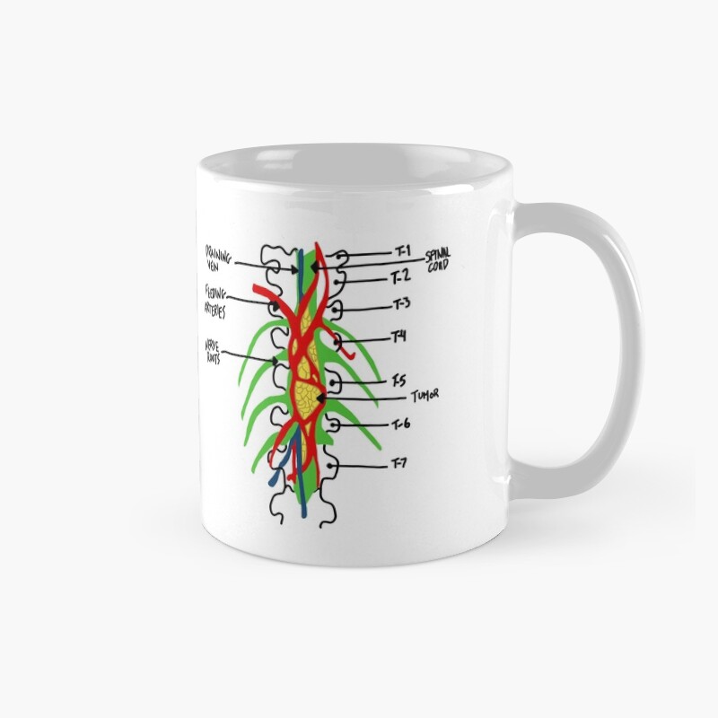 Grey's Anatomy Tumor Mug